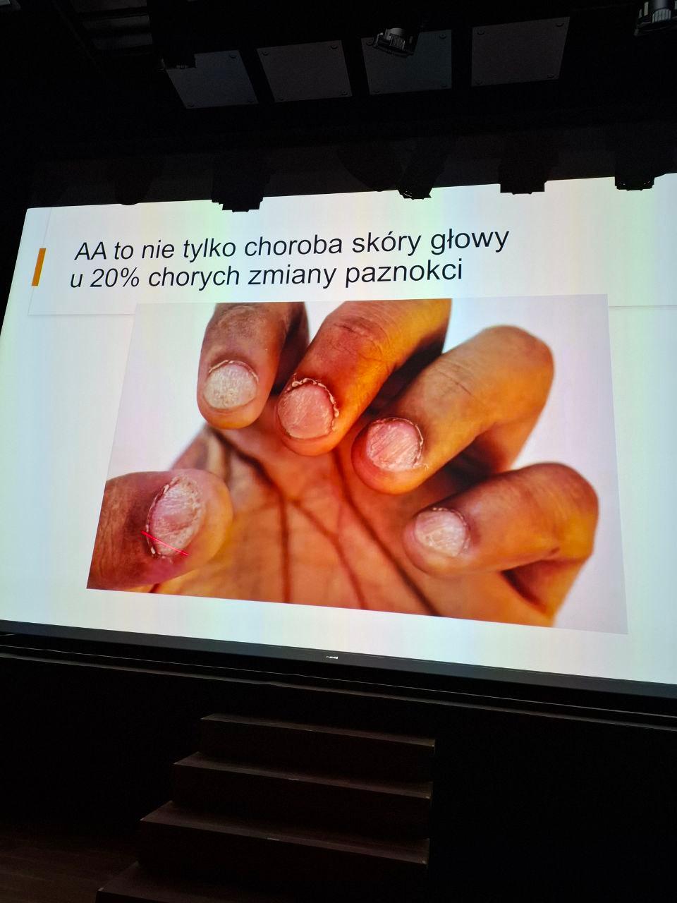 17. Konferencja "Praktycy - Praktykom". Jak dbać o zdrowie młodych dorosłych?